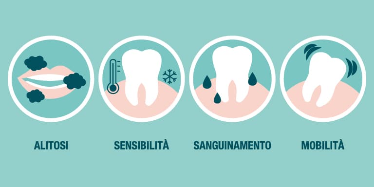 riconoscere i sintomi della parodontite